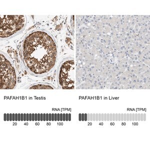 Merck Anti-PAFAH1B1 antibody produced in rabbit