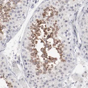 Merck Anti-FSCB antibody produced in rabbit