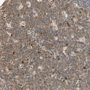 Merck Anti-QSER1 antibody produced in rabbit