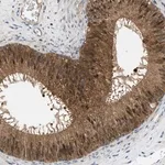 Merck Anti-GMPPB antibody produced in rabbit