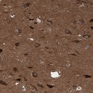 Merck Anti-ITFG1 antibody produced in rabbit