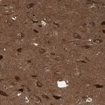 Merck Anti-ITFG1 antibody produced in rabbit