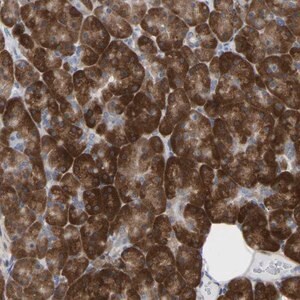 Merck Anti-UBE4B antibody produced in rabbit