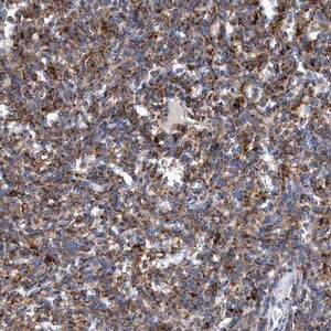 Merck Anti-TRIM65 antibody produced in rabbit