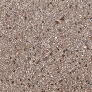 Merck Anti-SGSM2 antibody produced in rabbit