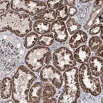 Merck Anti-EXOSC2 antibody produced in rabbit