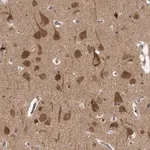 Merck Anti-CACYBP antibody produced in rabbit