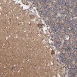 Merck Anti-CAMK2D antibody produced in rabbit