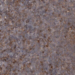 Merck Anti-RAB3GAP2 antibody produced in rabbit