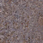 Merck Anti-RAB3GAP2 antibody produced in rabbit