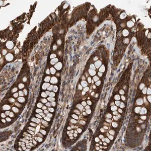 Merck Anti-ABCA5 antibody produced in rabbit