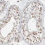 Merck Anti-CDCA2 antibody produced in rabbit