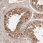 Merck Anti-CENPU antibody produced in rabbit
