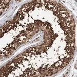 Merck Anti-STXBP4 antibody produced in rabbit