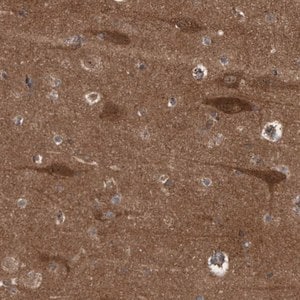 Merck Anti-RAP1GAP2 antibody produced in rabbit