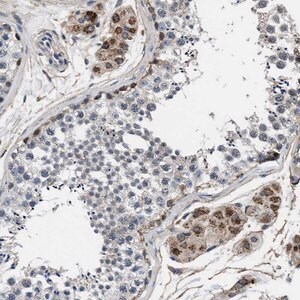 Merck Anti-NKTR antibody produced in rabbit