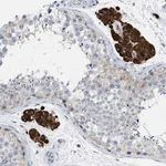 Merck Anti-PPM1D antibody produced in rabbit