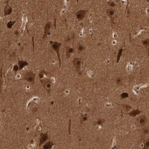 Merck Anti-AKT3 antibody produced in rabbit
