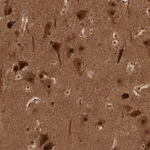 Merck Anti-AKT3 antibody produced in rabbit