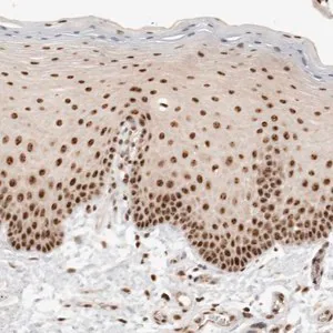 Merck Anti-EBNA1BP2 antibody produced in rabbit