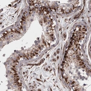 Merck Anti-FAAP100 antibody produced in rabbit