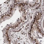 Merck Anti-FAAP100 antibody produced in rabbit