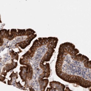 Merck Anti-LRRC40 antibody produced in rabbit