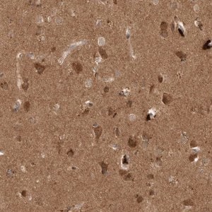 Merck Anti-PITPNC1 antibody produced in rabbit