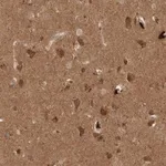 Merck Anti-PITPNC1 antibody produced in rabbit