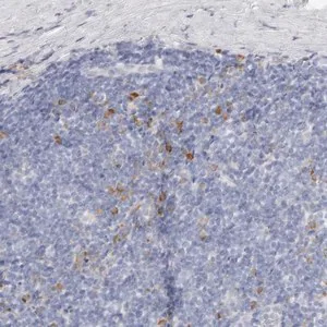 Merck Anti-CSK antibody produced in rabbit