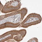 Merck Anti-NPC1 antibody produced in rabbit