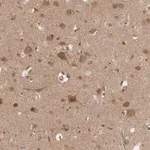 Merck Anti-VPS50 antibody produced in rabbit