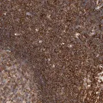 Merck Anti-CCDC88B antibody produced in rabbit