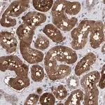 Merck Anti-TSTD2 antibody produced in rabbit