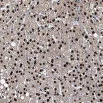 Merck Anti-ZNF20 antibody produced in rabbit