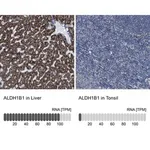 Merck Anti-ALDH1B1 antibody produced in rabbit