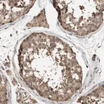 Merck Anti-NAA35 antibody produced in rabbit