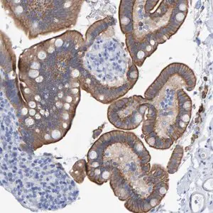 Merck Anti-JAKMIP3 antibody produced in rabbit