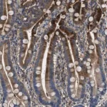 Merck Anti-BLOC1S1 antibody produced in rabbit