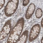 Merck Anti-COASY antibody produced in rabbit