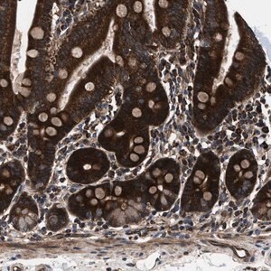 Merck Anti-PRR15L antibody produced in rabbit