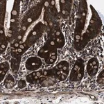 Merck Anti-PRR15L antibody produced in rabbit