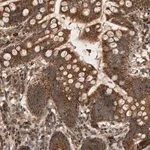 Merck Anti-GSTK1 antibody produced in rabbit