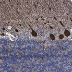 Merck Anti-TXNDC17 antibody produced in rabbit