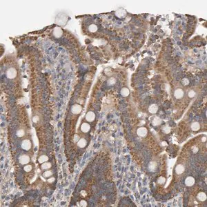 Merck Anti-TOM1L1 antibody produced in rabbit