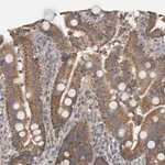 Merck Anti-TOM1L1 antibody produced in rabbit