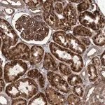 Merck Anti-SLC25A10 antibody produced in rabbit