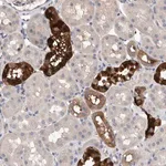 Merck Anti-SLC45A4 antibody produced in rabbit