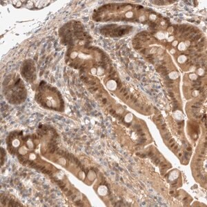 Merck Anti-CARNMT1 antibody produced in rabbit