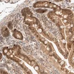 Merck Anti-CARNMT1 antibody produced in rabbit